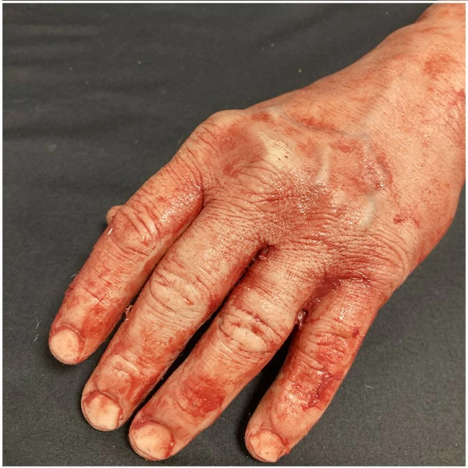 Other Silicone Severed Full Arm - Image 7