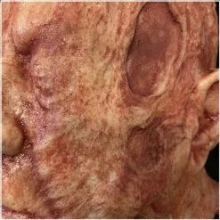 Other Silicone Severed Head Clarence, Burned -Halloween Gear Sales 4 clarence burned silicone severed head horror prop