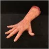 Other Silicone Male Arm Cadaver
