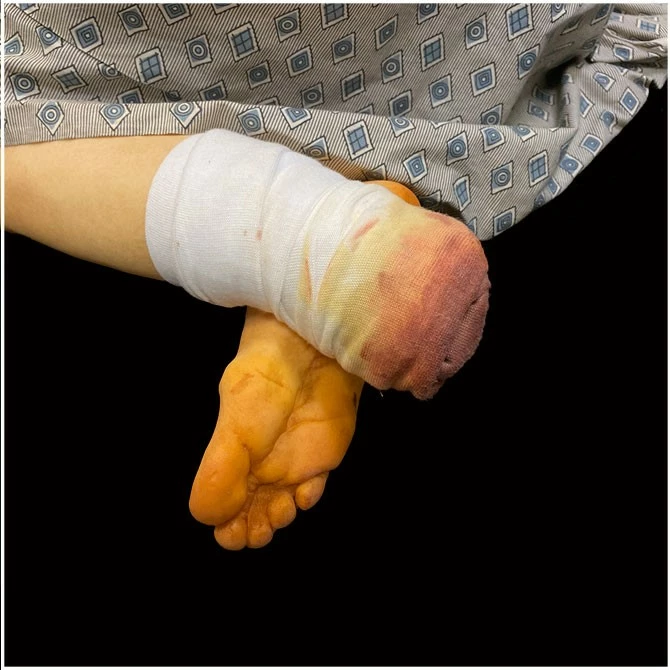 Ghost Ride Productions Life Size Body Mindi Stumpy 4 Ghost Ride Productions Life Size Body Mindi Stumpy - Image 4