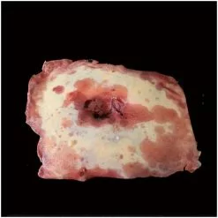 Other Silicone Severed Belly Button